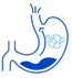 Esophageal Cancer