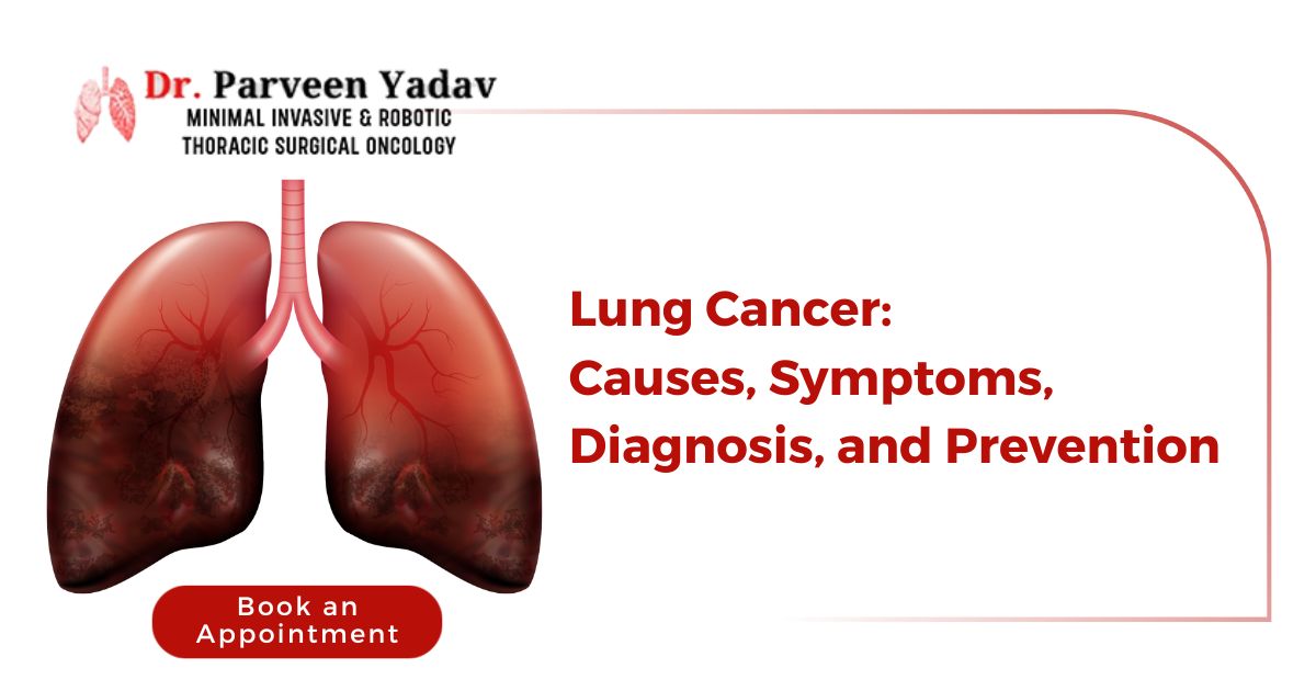 A Guide to Lung Cancer at Chest Surgery India with Dr. Parveen Yadav