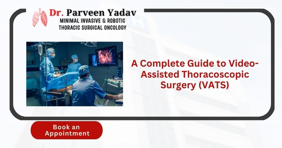 Video-Assisted Thoracoscopic Surgery (VATS) A Complete Guide