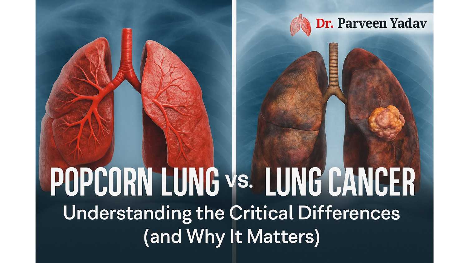 Popcorn Lung vs. Lung Cancer: Understanding the Critical Differences (and Why It Matters)